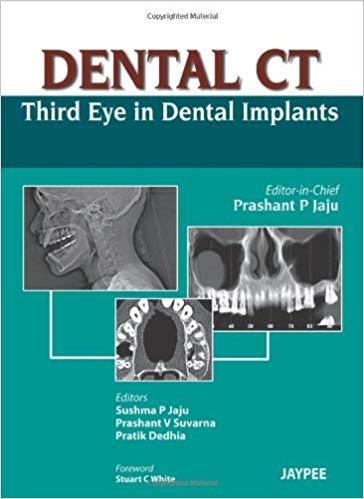 Dental CT - Third Eye in Dental Implants