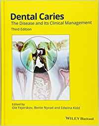 Dental Caries The Disease and Its Clinical Management 3rd Edition