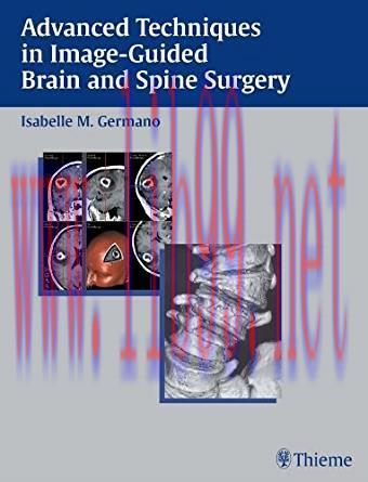 [PDF]Advanced Techniques in Image-Guided Brain and Spine Surgery, 1e