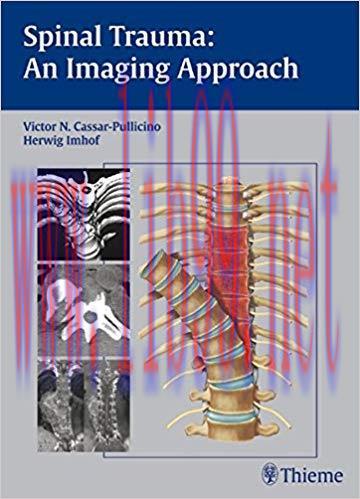 [PDF]Spinal Trauma - An Imaging Approach