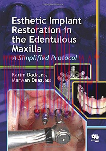 [AME]Esthetic Implant Restoration in the Edentulous Maxilla: A Simplified Protocol