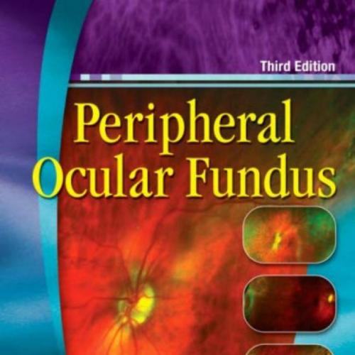 Peripheral Ocular Fundus, Third Edition
