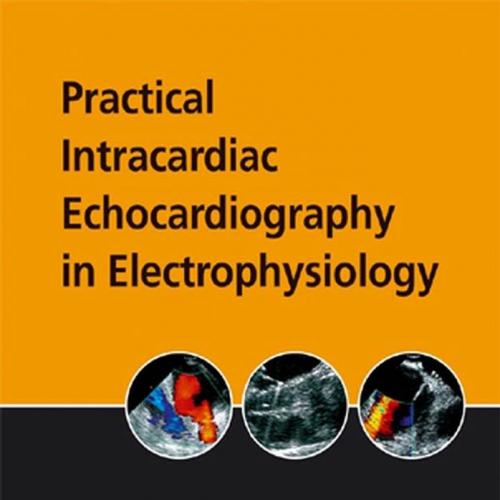 Practical Intracardiac Echocardiography in Electrophysiology