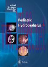 [PDF]Pediatric Hydrocephalus