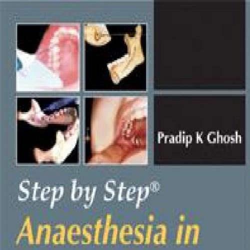 Step by Step Anaesthesia in Dentistry Local and General