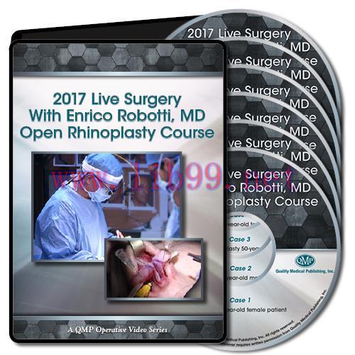 [AME]QMP 2017 Live Surgery With Enrico Robotti Open Rhinoplasty Course (CME VIDEOS)