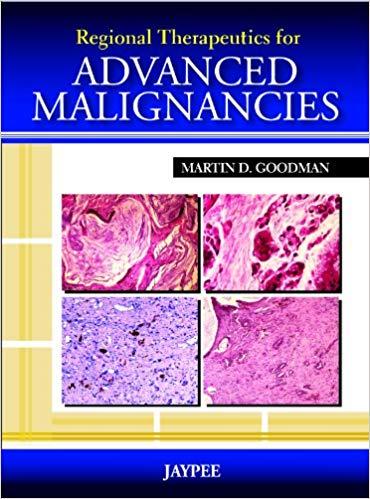 Regional Therapeutics for Advanced Malignancies