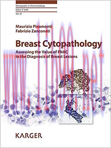 [PDF]Breast Cytopathology - Assessing the Value of FNAC in the Diagnosis of Breast Lesions