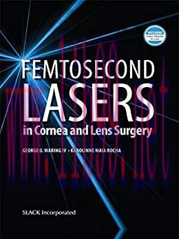 [PDF]Femtosecond Lasers in Cornea and Lens Surgery