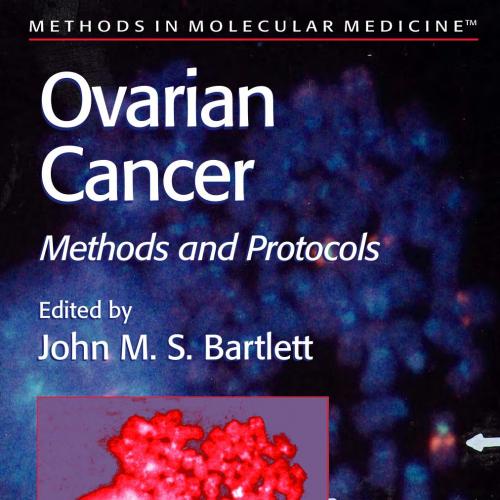 Ovarian Cancer- Methods and Protocols