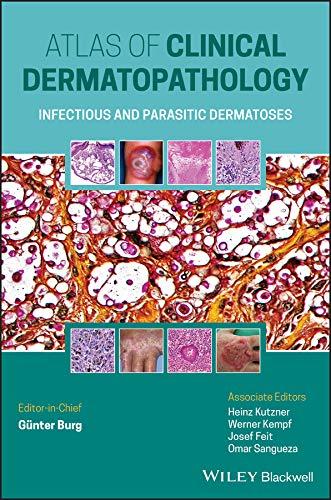 Atlas of Clinical Dermatopathology