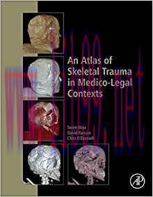 [PDF]An Atlas of Skeletal Trauma in Medico-Legal Contexts