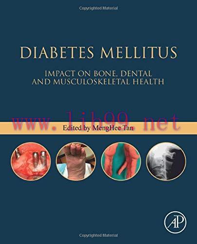 [AME]Diabetes Mellitus: Impact on Bone, Dental and Musculoskeletal Health (Bones, Joints, and H...