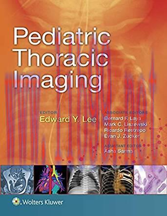 [EPUB]Pediatric Thoracic Imaging