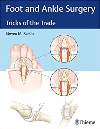 Foot and Ankle Surgery Tricks of the Trade