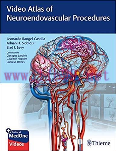 [PDF]Video Atlas of Neuroendovascular Procedures, PDF+ (11.9GB) 138 VIDEOS