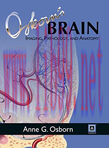 [FOX-Ebook]Osborn's Brain
