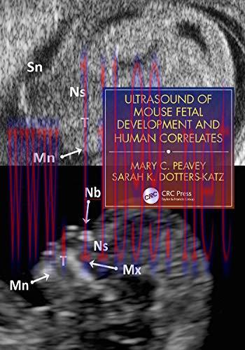 [AME]Ultrasound of Mouse Fetal Development and Human Correlates (Reproductive Medicine and Assi...