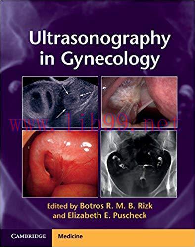 [PDF]Ultrasonography in Gynecology