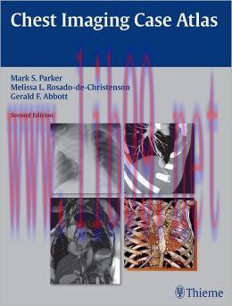[AME]Chest Imaging Case Atlas, 2nd Edition (ORIGINAL PDF from_ Publisher)