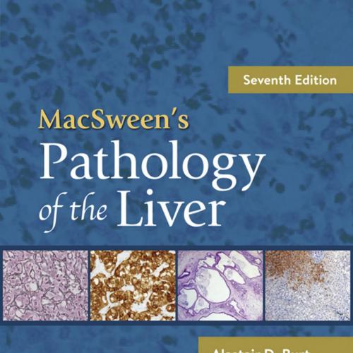 MacSween's Pathology of the Liver 7th
