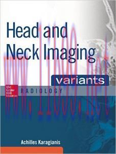 [AME]Head and Neck Imaging Variants (ePUB)