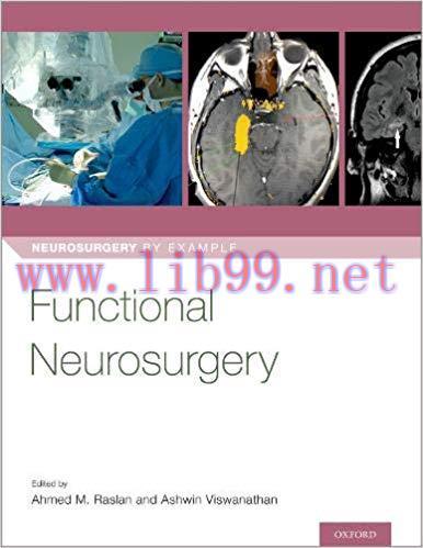 [AME]Functional Neurosurgery (Neurosurgery by Example)