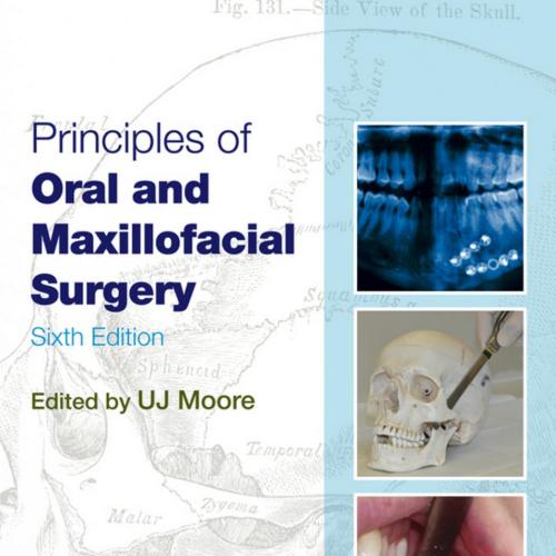 Principles of Oral and Maxillofacial Surgery, Sixth Edition - U J Moore
