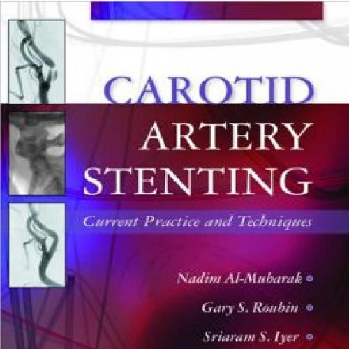 Carotid Artery Stenting Current Practice and Techniques
