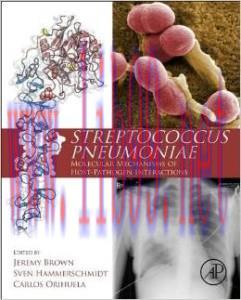[AME]Streptococcus Pneumoniae: Molecular Mechanisms of Host-Pathogen Interactions
