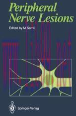 [PDF]Peripheral Nerve Lesions