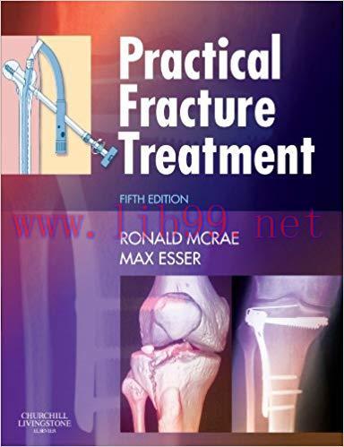 [PDF]Practical Fracture Treatment, 5th Edition
