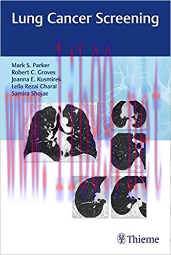 [PDF]Lung Cancer Screening