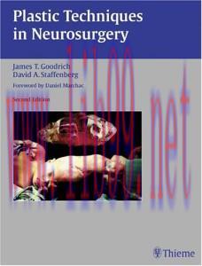[AME]Plastic Techniques in Neurosurgery, 2nd Edition (High Quality PDF)