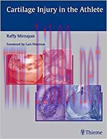 [PDF]Cartilage Injury in the Athlete