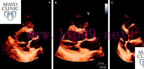[AME]Mayo Clinic Echocardiography Board Review 2019 (CME VIDEOS)