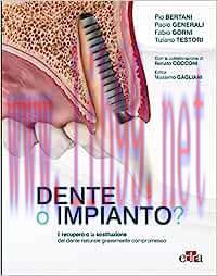 [AME]Dente o impianto? Il recupero e la sostituzione del dente naturale gravemente compromesso ...