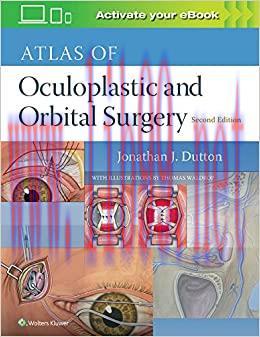 [AME]Atlas of Oculoplastic and Orbital Surgery, 2nd edition (Original PDF)