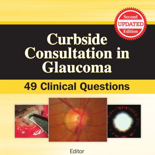 Curbside Consultation in Glaucoma 49 Clinical Questions 2nd Edition