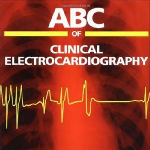 ABC of Clinical Electrocardiography