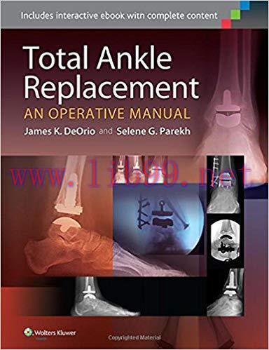[PDF]Total Ankle Replacement - An Operative Manual +CHM版
