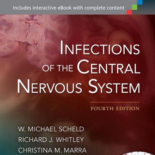 Infections of the Central Nervous System