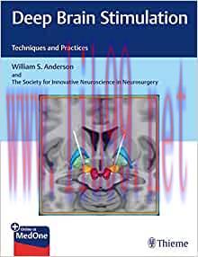 [AME]Deep Brain Stimulation: Techniques and Practices (EPUB)