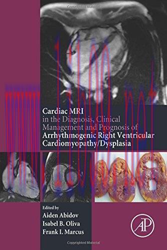 [AME]The Cardiac MRI in Diagnosis, Clinical Management, and Prognosis of Arrhythmogenic Right V...