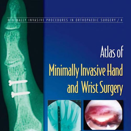 Atlas of Minimally Invasive Hand and Wrist Surgery