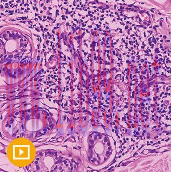 [AME]Dermatopathology 2023 (CME VIDEOS)