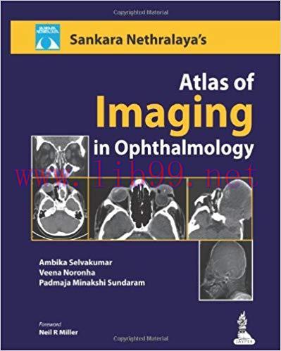 [PDF]Sankara Nethralaya’s Atlas Of Imaging In Ophthalmology