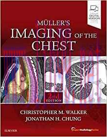 [PDF]Muller’s Imaging of the Chest: Expert Radiology Series 2nd Edition