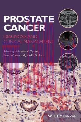 [AME]Prostate Cancer: Diagnosis and Clinical Management