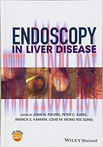 [PDF]Endoscopy in Liver Disease